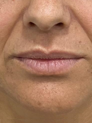 Bigode Chinês 1 - Antes