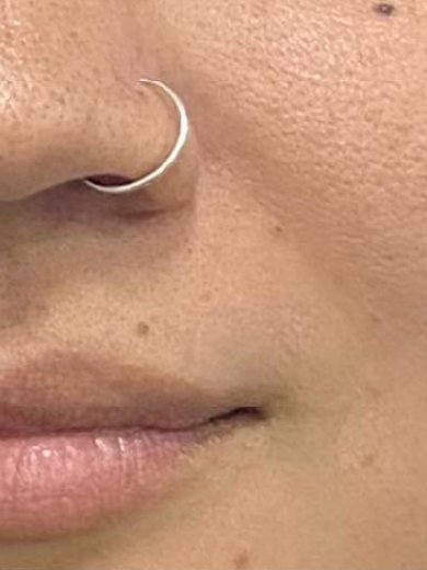 Bigode Chinês 2 - Antes