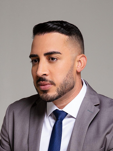 Harmonização Facial 1 - Depois