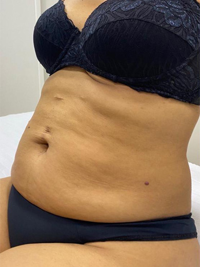 Method Harmony 2 - Antes